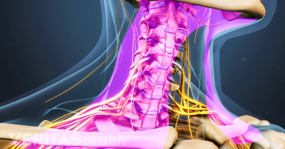 Lumbar Decompression and Fusion Surgery