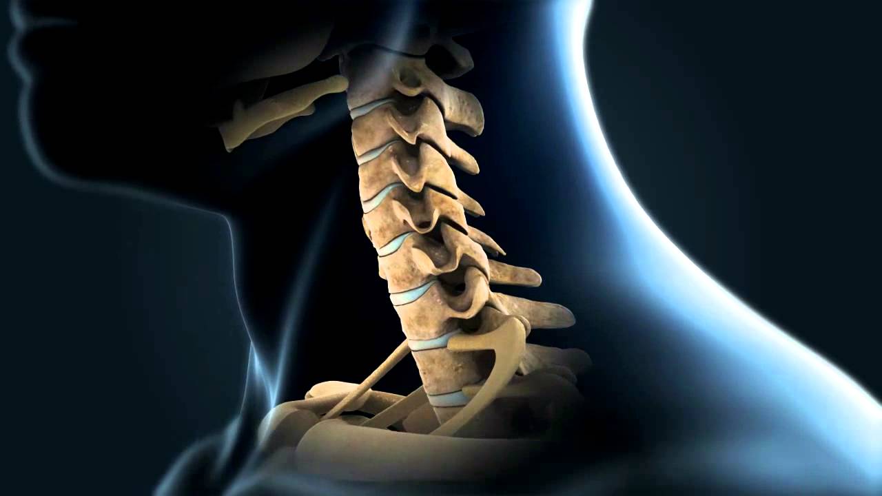 Cervical disc replacement