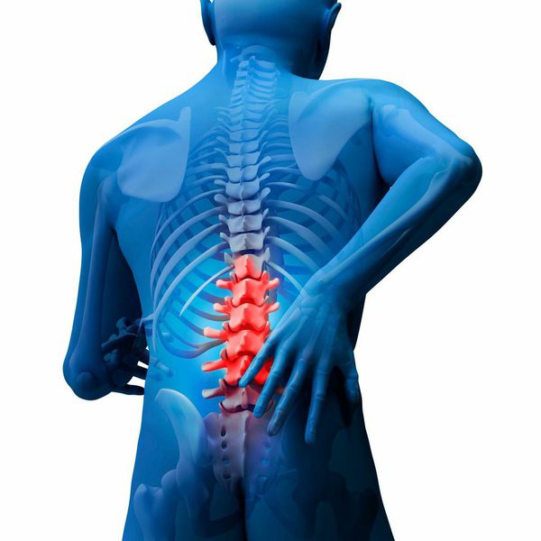 Spinal Tumors