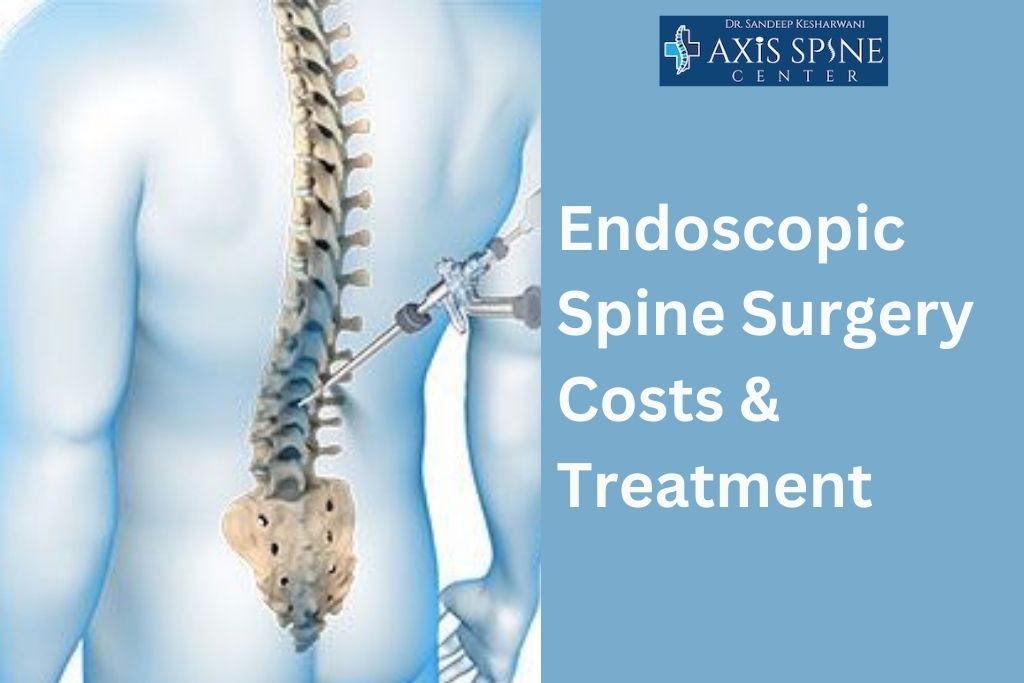 Endoscopic Spine Surgery Costs & Treatment Options in India | Axis Spine Centre