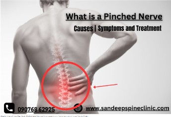 What is low back pain?