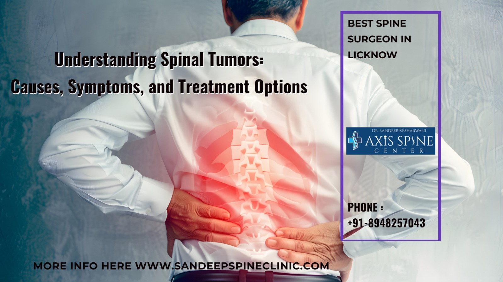 Understanding Spinal Tumors: Causes, Symptoms, and Treatment Options
